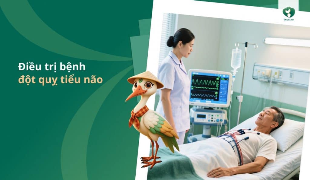 Điều trị bệnh đột quỵ tiểu não