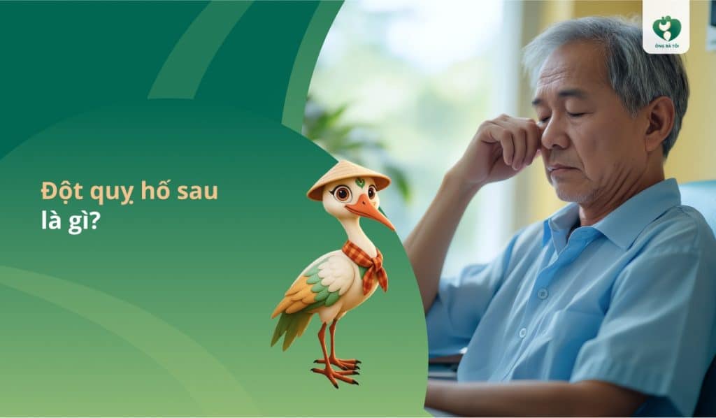 Đột quỵ hố sau là gì