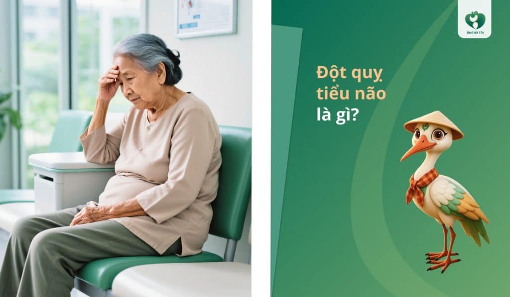 Đột quỵ tiểu não là gì