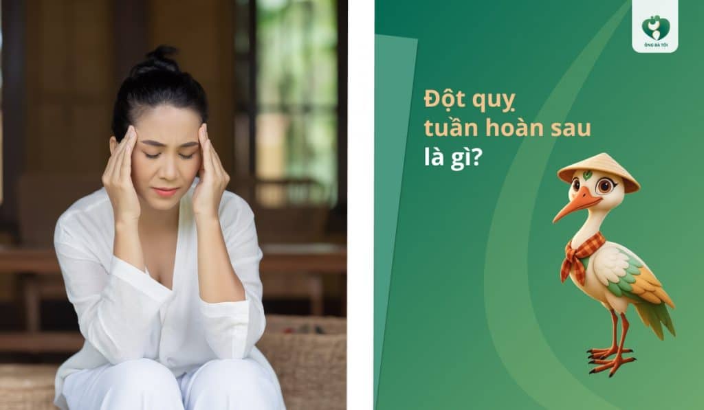 Đột quỵ tuần hoàn sau là gì