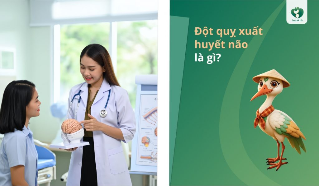 Đột quỵ xuất huyết não là gì