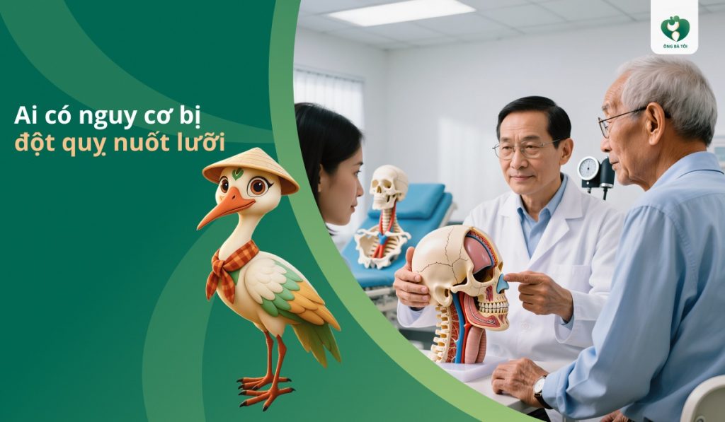 Ai có nguy cơ bị đột quỵ nuốt lưỡi