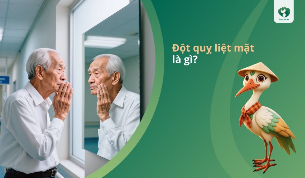 Đột quỵ liệt mặt