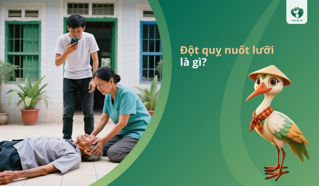 Đột quỵ nuốt lưỡi là gì