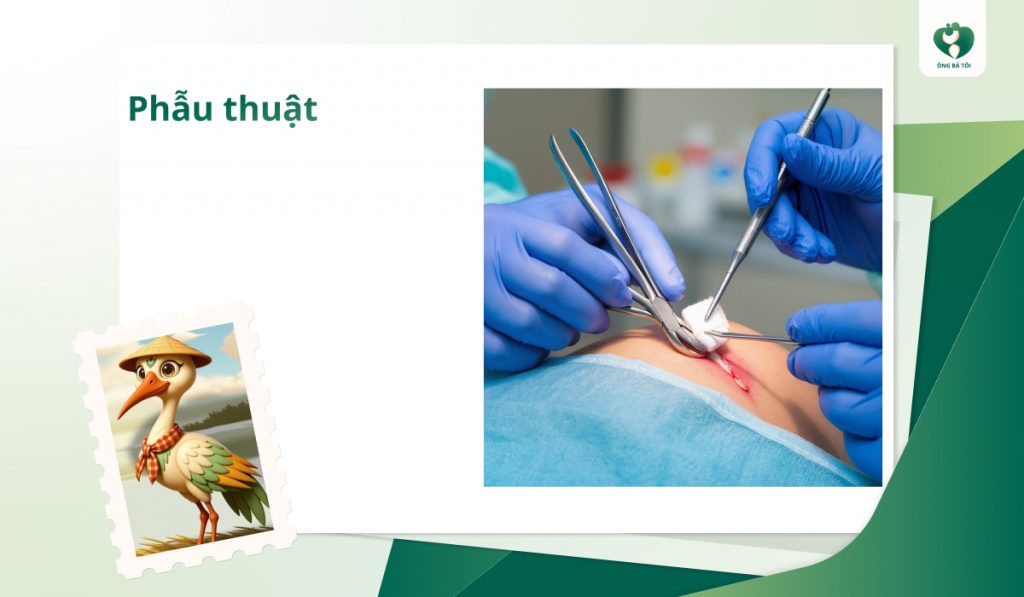 Phẫu thuật