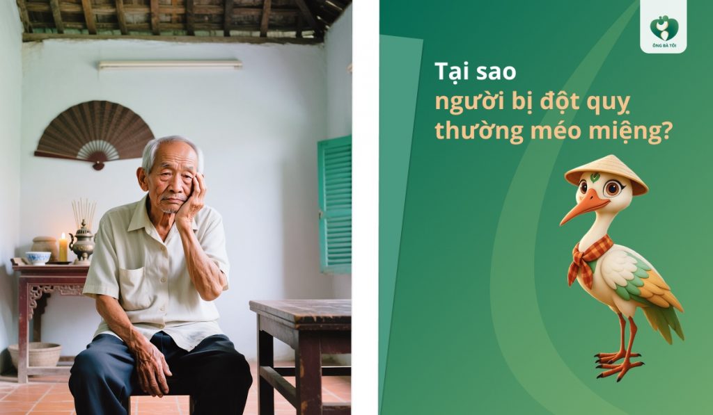 Tại sao người bị đột quỵ thường méo miệng